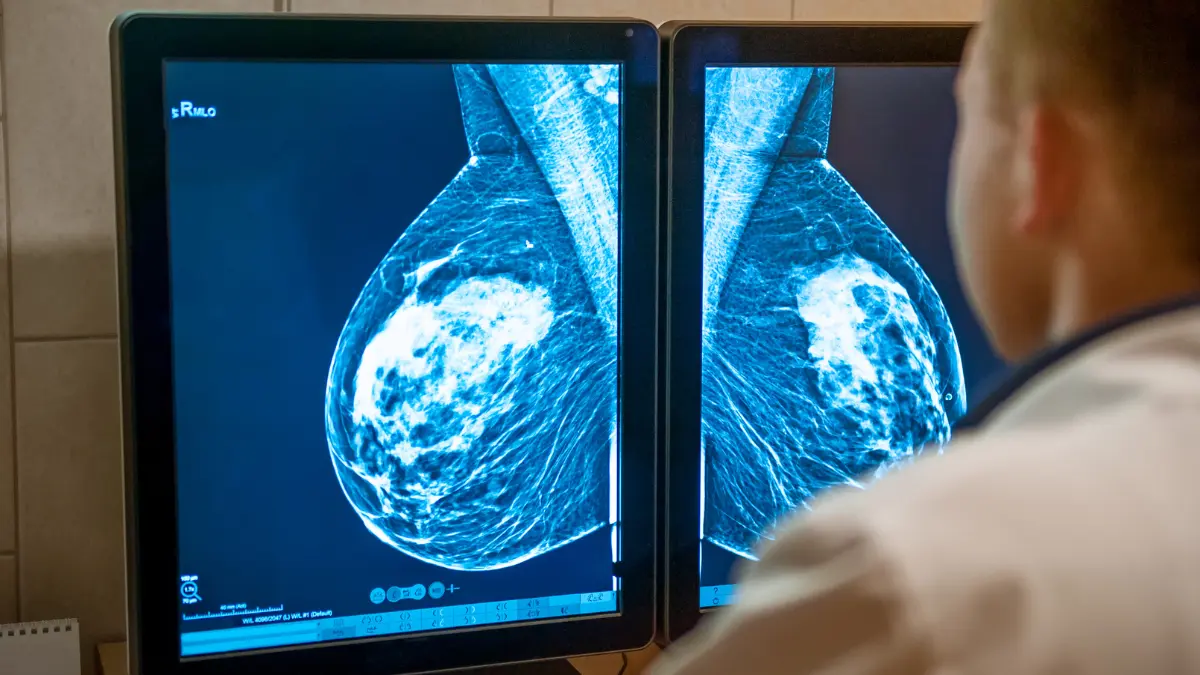 Doctor reviewing mammogram screening images on two side-by-side monitors